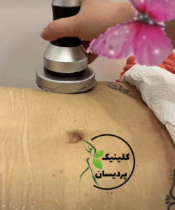 نمونه آر اف لاغری کلینیک پردیسان