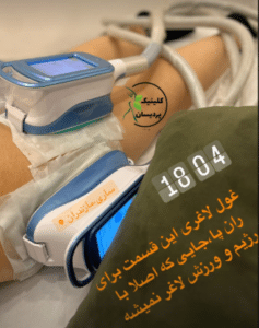 نمونه کرایولیپولیز لاغری کلینیک پردیسان