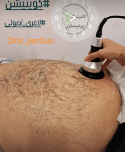 نمونه کویتیشن لاغری کلینیک پردیسان
