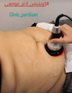 نمونه کویتیشن لاغری کلینیک پردیسان