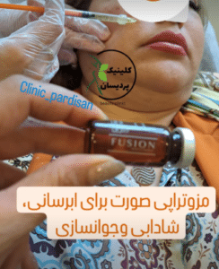 نمونه مزو لاغری کلینیک پردیسان