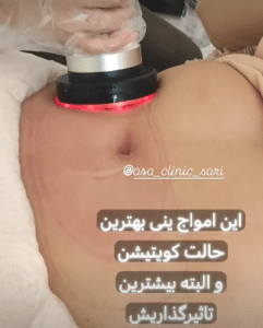 نمونه کویتیشن لاغری مرکز لاغری آسا