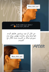 نظر کاربر اینستاگرام (مرکز لاغری آسا)