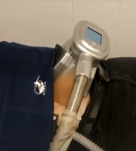 نمونه لاغری موضعی مرکز لاغری پردیس