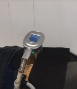 نمونه لاغری موضعی مرکز لاغری پردیس