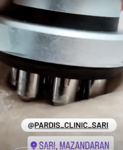 نمونه لاغری موضعی مرکز لاغری پردیس