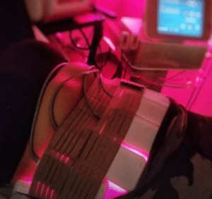 نمونه لاغری موضعی مرکز لاغری پردیس