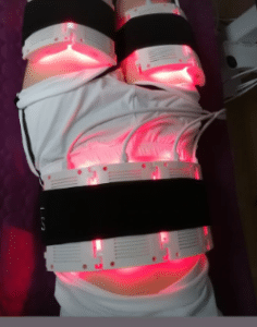 نمونه لاغری موضعی مرکز لاغری پردیس