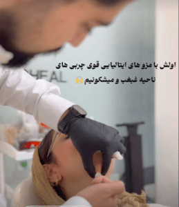 نمونه لاغری موضعی دکتر محمدامین صنعتی