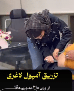 نمونه لاغری موضعی دکتر محمدامین صنعتی