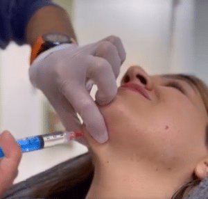 نمونه لاغری موضعی دکتر محمدامین صنعتی