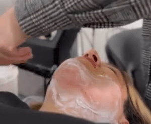 نمونه لاغری موضعی دکتر محمدامین صنعتی