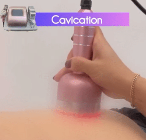 نمونه لاغری موضعی دکتر سید محمد رضا قریشی