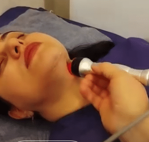 نمونه لاغری موضعی دکتر رجا قلیان