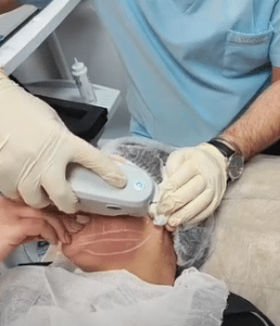 نمونه لاغری موضعی کلینیک زیبایی کاژه