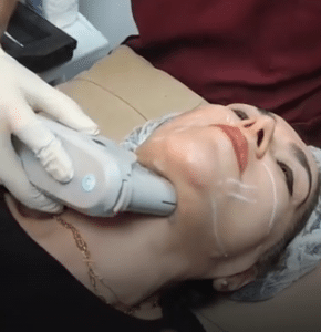 نمونه لاغری موضعی کلینیک زیبایی کاژه