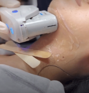 نمونه لاغری موضعی کلینیک زیبایی کاژه