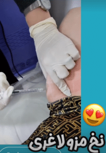 نمونه لاغری موضعی کلینیک زیبایی دانژه