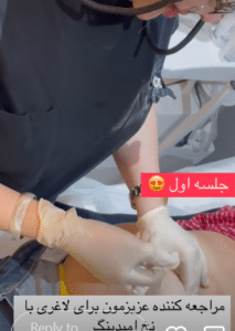 نمونه لاغری موضعی کلینیک زیبایی دانژه