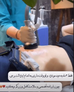 نمونه لاغری موضعی کلینیک زیبایی دانژه