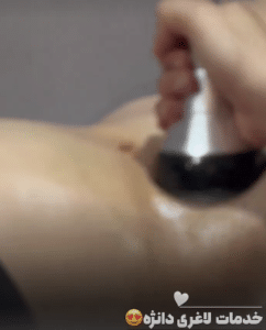 نمونه لاغری موضعی کلینیک زیبایی دانژه