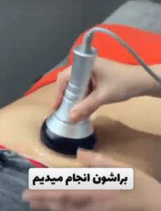 نمونه لاغری موضعی کلینیک زیبایی دانژه