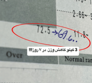 نمونه لاغری موضعی دکتر علی خوش نظر