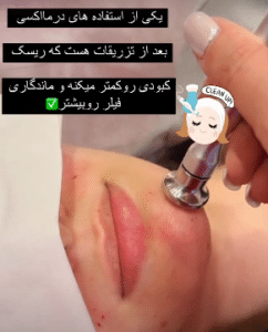 نمونه درمان های پوستی دکتر سارا احتشامی