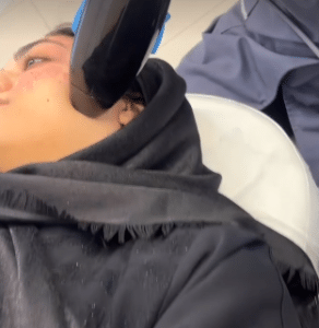 نمونه درمان های پوستی دکتر محمود جعفری