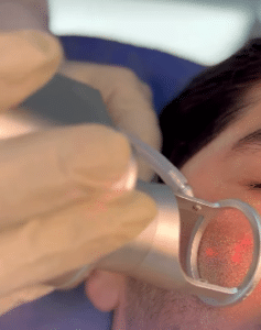 نمونه درمان لک های پوستی دکتر قاسم رحمت پور رکنی