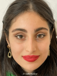 نمونه درمان مشکلات پوستی دکتر گالیا رنجبری