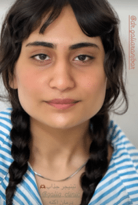 نمونه درمان مشکلات پوستی دکتر گالیا رنجبری