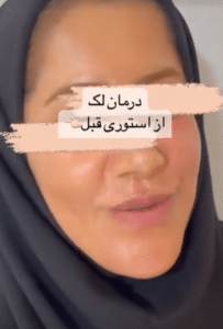 نمونه درمان مشکلات پوستی دکتر گالیا رنجبری