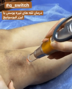 نمونه درمان مشکلات پوستی دکتر گالیا رنجبری