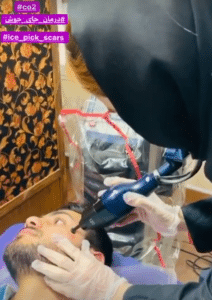 نمونه درمان مشکلات پوستی دکتر گالیا رنجبری