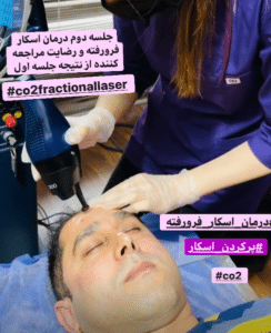 نمونه درمان مشکلات پوستی دکتر گالیا رنجبری