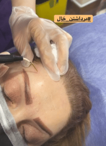 نمونه درمان مشکلات پوستی دکتر گالیا رنجبری