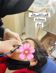 نمونه درمان مشکلات پوستی دکتر گالیا رنجبری