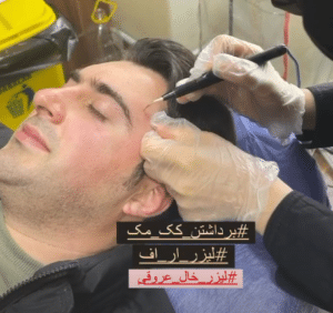 نمونه درمان مشکلات پوستی دکتر گالیا رنجبری