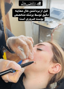 نمونه درمان مشکلات پوستی دکتر گالیا رنجبری