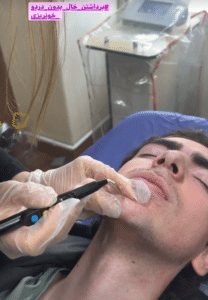 نمونه درمان مشکلات پوستی دکتر گالیا رنجبری