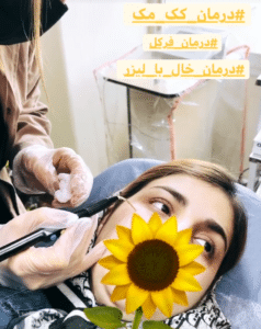 نمونه درمان مشکلات پوستی دکتر گالیا رنجبری