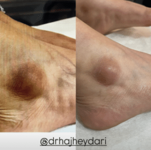 نمونه درمان مشکلات پوستی دکتر زهره حاج حیدری