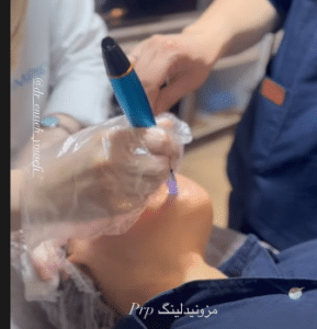 نمونه درمان مشکلات پوستی دکتر زهره حاج حیدری