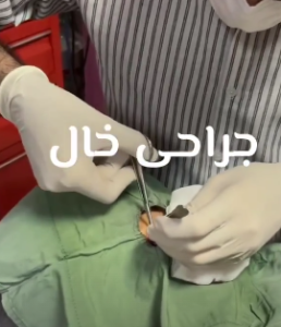 نمونه درمان مشکلات پوستی دکتر صادق هاشمی نسب