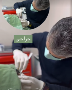 نمونه درمان مشکلات پوستی دکتر صادق هاشمی نسب