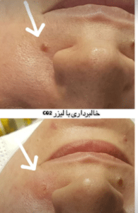 درمان بیماری های پوستی دکتر حشمت الله بابائی