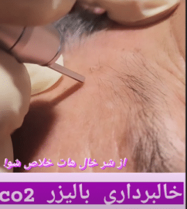 درمان بیماری های پوستی دکتر حشمت الله بابائی