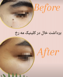 درمان بیماری های پوستی دکتر حشمت الله بابائی