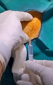 نمونه درمان مشکلات پوستی دکتر سید محمدرضا قریشی